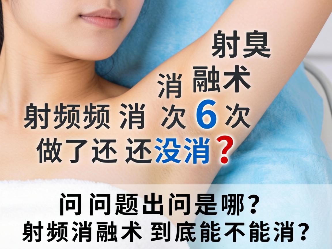 腋臭射频消融术做了6次还没消?问题出在哪?射频消融术到底能不能消? 腋臭射频消融术做了6次还没消?问题出在哪?射频消融术到底能不能消?