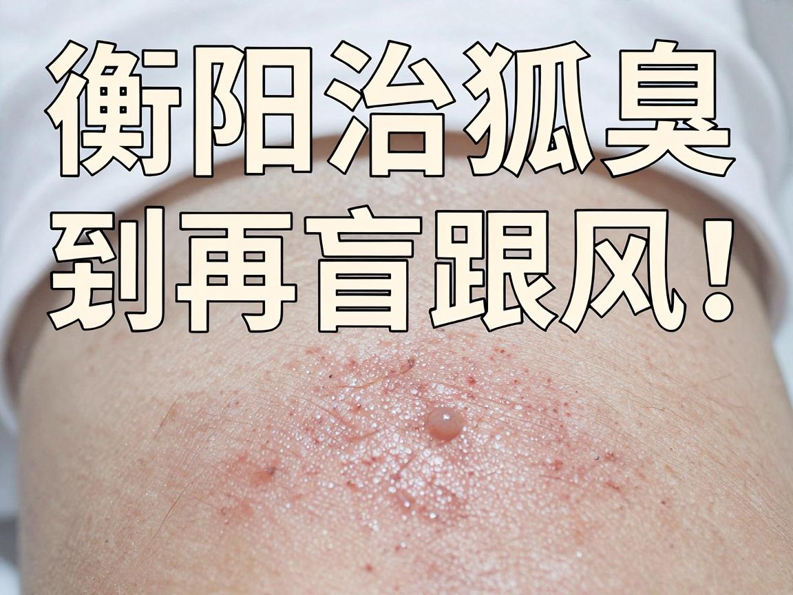 衡阳治狐臭,别再盲目跟风!衡阳治狐臭医院到底怎么选? 衡阳治狐臭,别再盲目跟风!衡阳治狐臭医院到底怎么选?