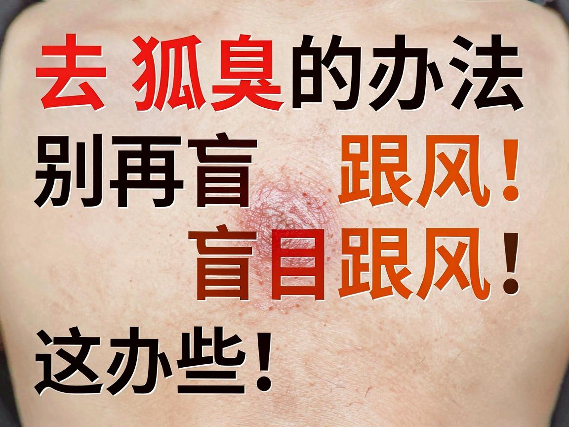 去狐臭的办法，别再盲目跟风！这些去狐臭的办法，附大专家一次说透