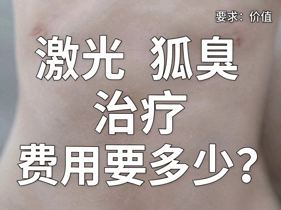 激光狐臭治疗费用要多少?一文讲清激光狐臭的价格与价值 激光狐臭治疗费用要多少?一文讲清激光狐臭的价格与价值