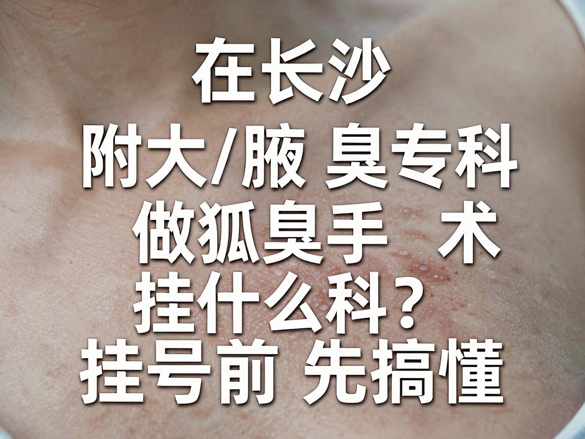 在长沙附大腋臭专科做狐臭手术挂什么科？挂号前先搞懂这三个关键点
