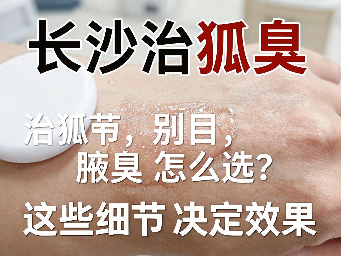 长沙治狐臭医院怎么选？治狐臭别盲目，这些细节决定效果