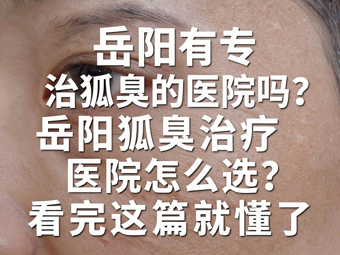岳阳有专治狐臭的医院吗?岳阳狐臭治疗医院怎么选?看完这篇就懂了 岳阳有专治狐臭的医院吗?岳阳狐臭治疗医院怎么选?看完这篇就懂了