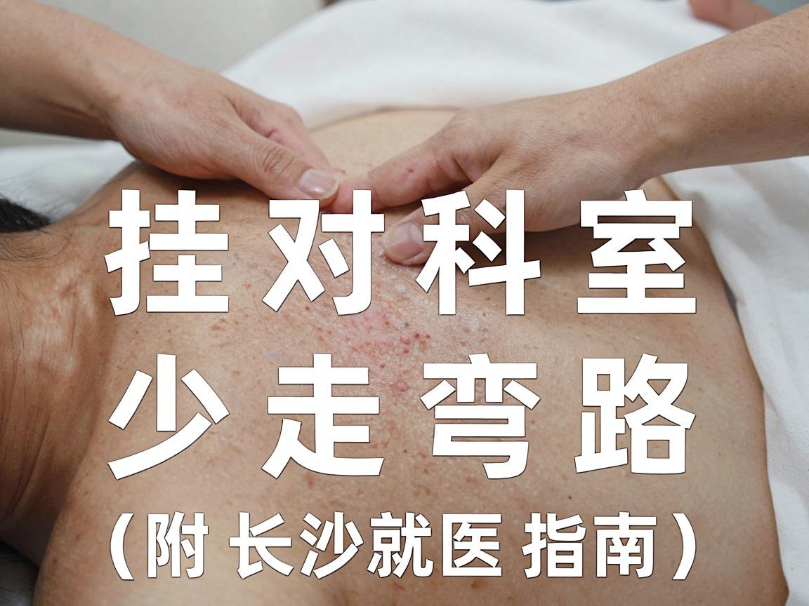 狐臭手术挂哪个科？挂对科室，少走弯路（附长沙就医指南）