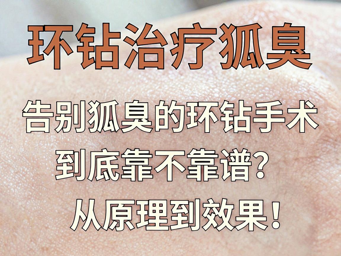 环钻治疗狐臭，告别狐臭的环钻手术，到底靠不靠谱？从原理到效果，一文说清环钻治疗狐臭的那些事儿