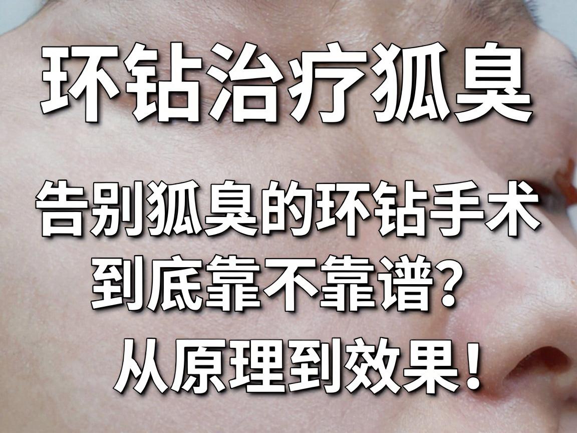 环钻治疗狐臭，告别狐臭的环钻手术，到底靠不靠谱？从原理到效果，一文说清环钻治疗狐臭的那些事儿