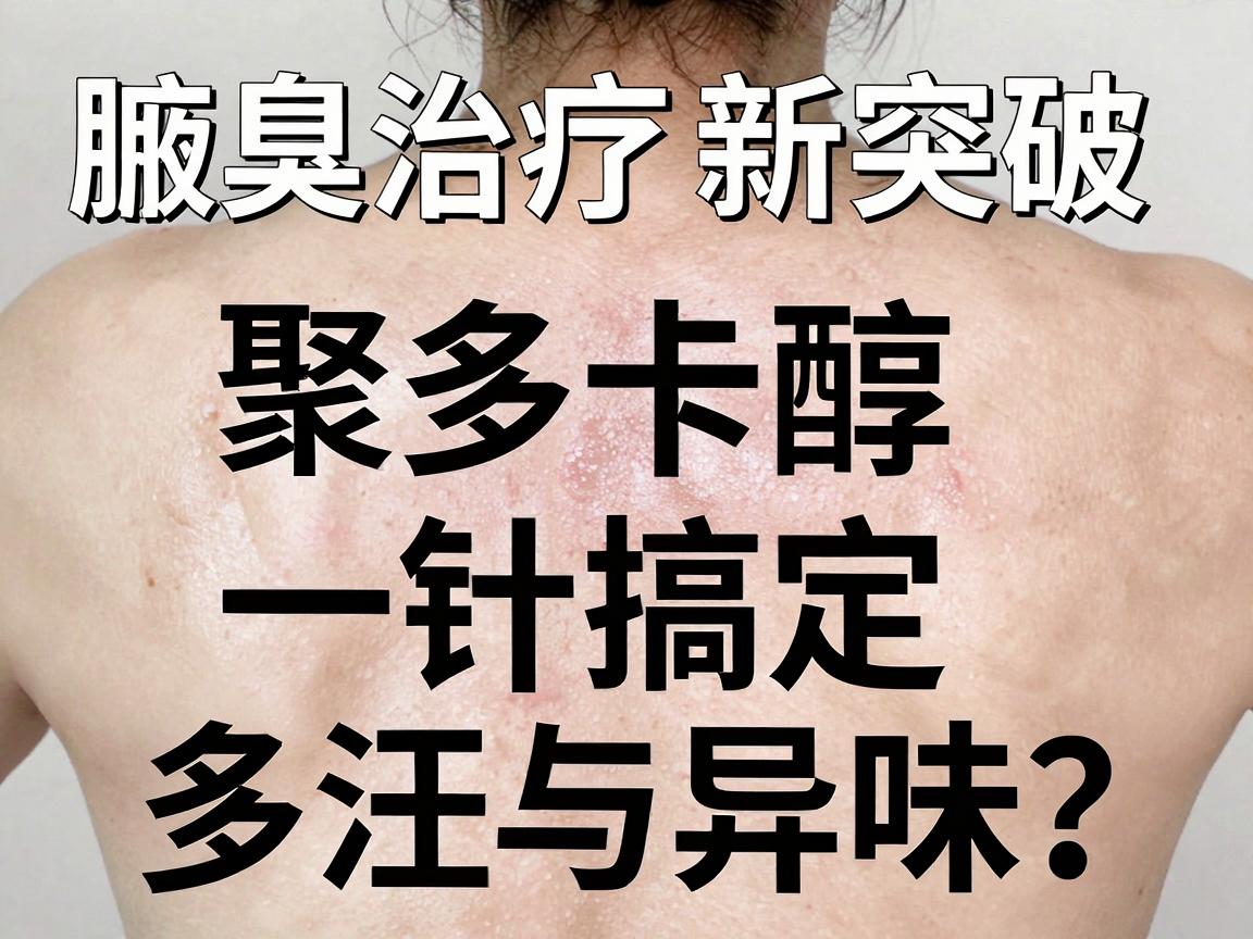 腋臭治疗新突破,聚多卡醇注射,一针搞定多汗与异味?聚多卡醇注射疗法深度解析 腋臭治疗新突破,聚多卡醇注射,一针搞定多汗与异味?聚多卡醇注射疗法深度解析