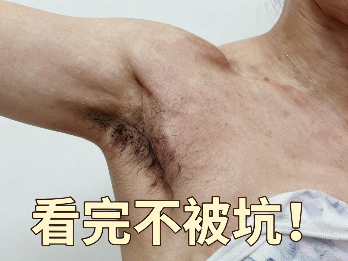 腋臭手术多少钱?影响腋臭手术价格的因素全解析,看完不被坑! 腋臭手术多少钱?影响腋臭手术价格的因素全解析,看完不被坑!