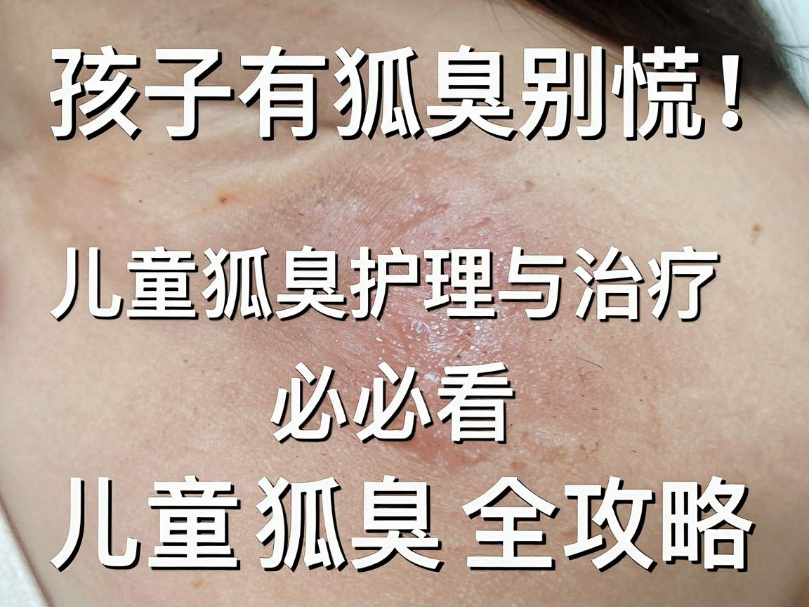 孩子有狐臭别慌!儿童狐臭护理与治疗,家长必看的儿童狐臭全攻略 孩子有狐臭别慌!儿童狐臭护理与治疗,家长必看的儿童狐臭全攻略