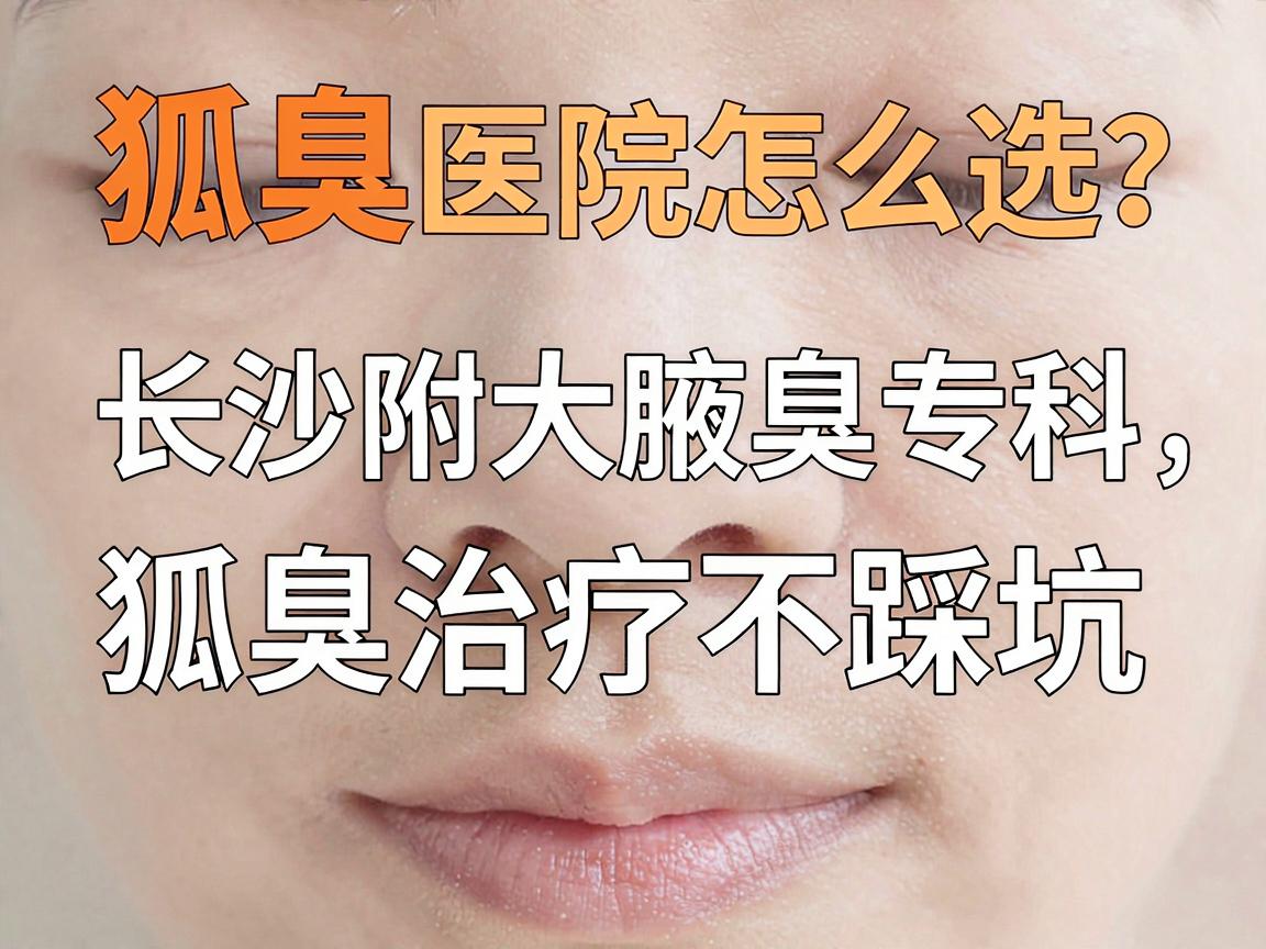 狐臭医院怎么选？长沙附大腋臭专科，狐臭治疗不踩坑的3个关键点