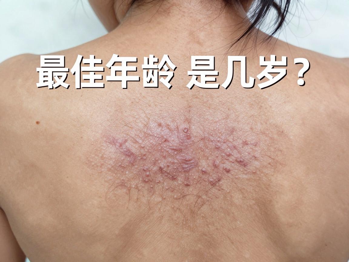 儿童狐臭手术最佳年龄是几岁？把握这个年龄窗口，手术效果更理想