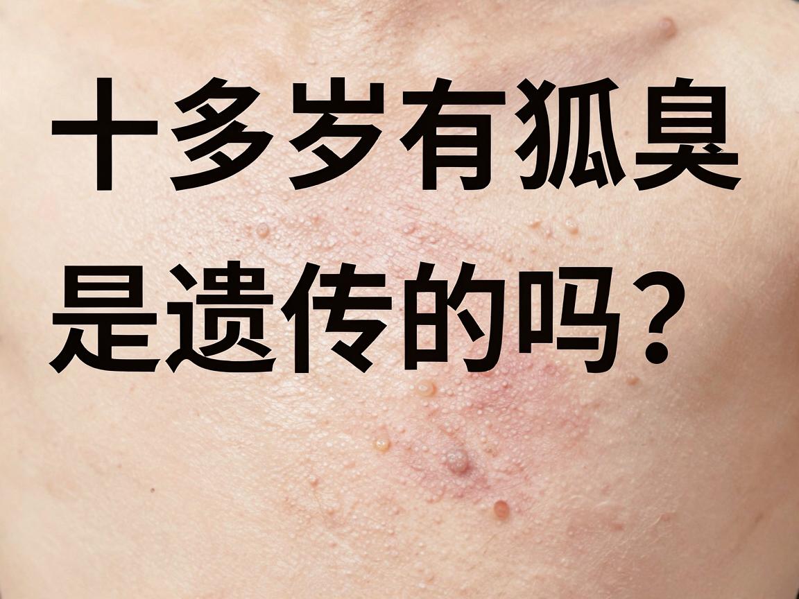 十多岁有狐臭，是遗传的吗？狐臭低龄化，家长别忽视这几点